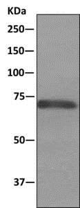 Immunoprecipitation - Anti-alpha 1 Fetoprotein antibody [EPR9309] - BSA and Azide free (AB188828), expandable thumbnail