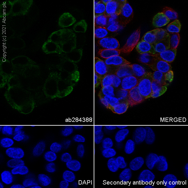 Immunocytochemistry - Anti-alpha 1 Fetoprotein antibody [RM1011] (AB284388), expandable thumbnail
