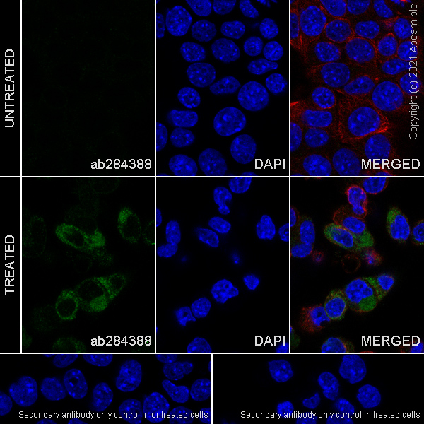Immunocytochemistry - Anti-alpha 1 Fetoprotein antibody [RM1011] (AB284388), expandable thumbnail