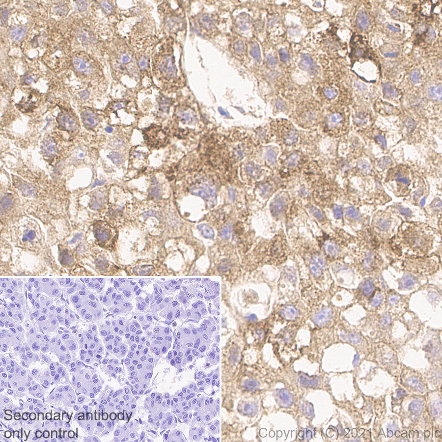 Immunohistochemistry (Formalin/PFA-fixed paraffin-embedded sections) - Anti-alpha 1 Fetoprotein antibody [RM1011] (AB284388), expandable thumbnail
