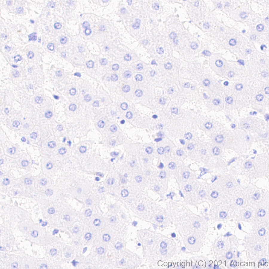 Immunohistochemistry (Formalin/PFA-fixed paraffin-embedded sections) - Anti-alpha 1 Fetoprotein antibody [RM1011] (AB284388), expandable thumbnail