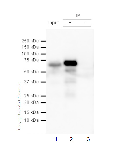 Immunoprecipitation - Anti-alpha 1 Fetoprotein antibody [RM1011] (ab284388), expandable thumbnail
