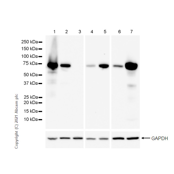 Western blot - Anti-alpha 1 Fetoprotein antibody [RM1011] (ab284388), expandable thumbnail