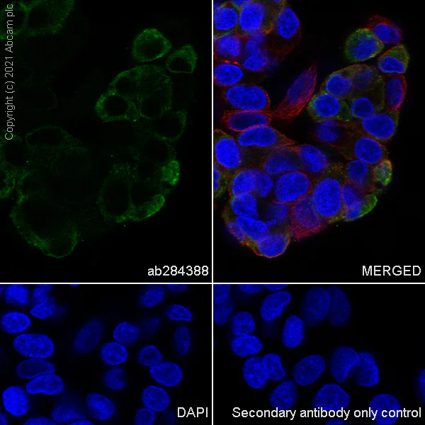 Immunocytochemistry - Anti-alpha 1 Fetoprotein antibody [RM1011] - BSA and Azide free (AB284396)