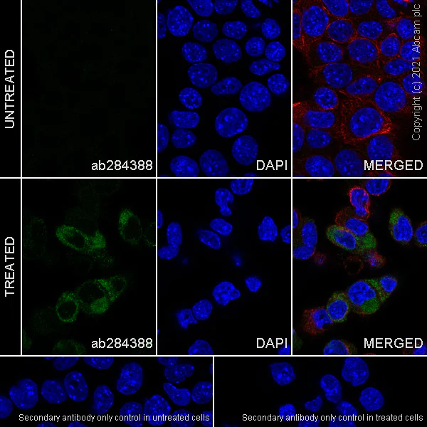 Immunocytochemistry - Anti-alpha 1 Fetoprotein antibody [RM1011] - BSA and Azide free (AB284396)