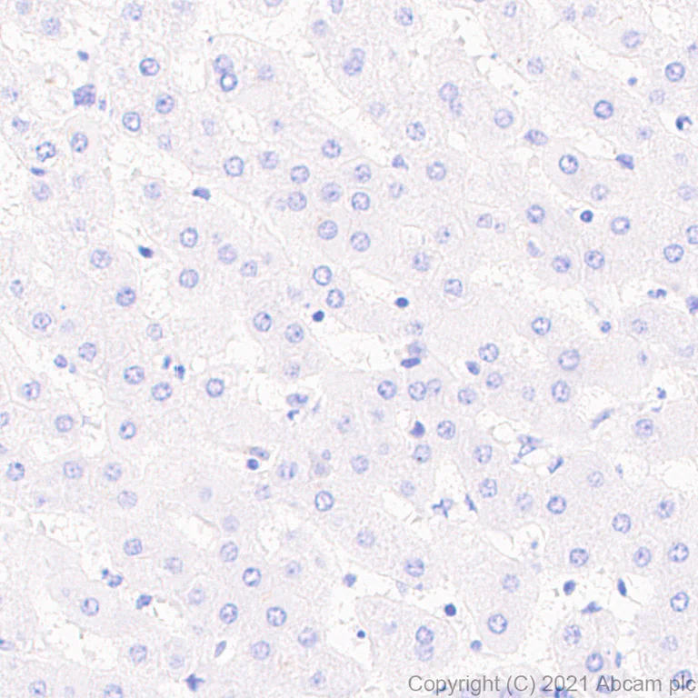 Immunohistochemistry (Formalin/PFA-fixed paraffin-embedded sections) - Anti-alpha 1 Fetoprotein antibody [RM1011] - BSA and Azide free (AB284396)