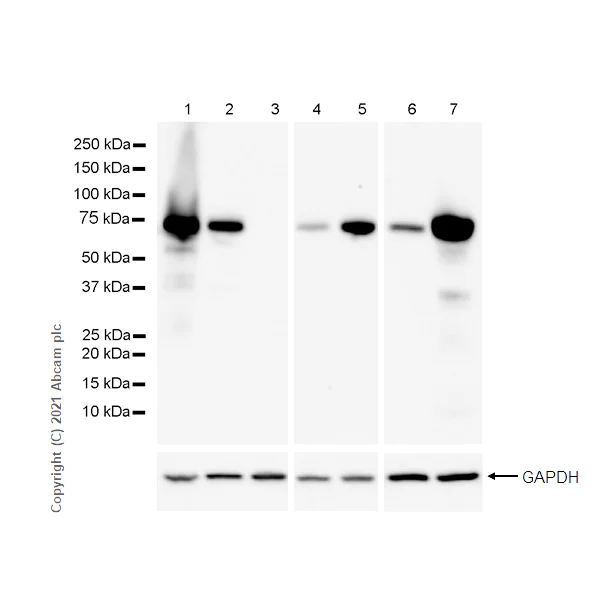 Western blot - Anti-alpha 1 Fetoprotein antibody [RM1011] - BSA and Azide free (AB284396)