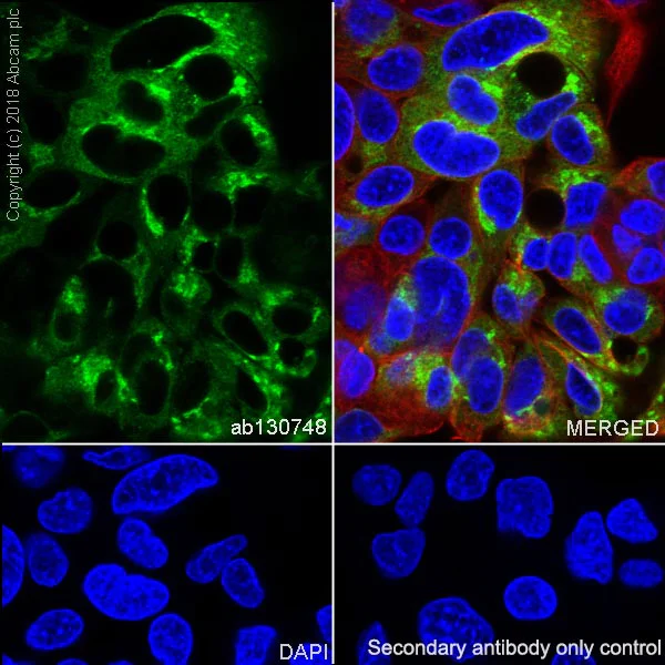 Immunocytochemistry/ Immunofluorescence - Anti-alpha 1 Fetoprotein antibody [SP154] (AB130748)