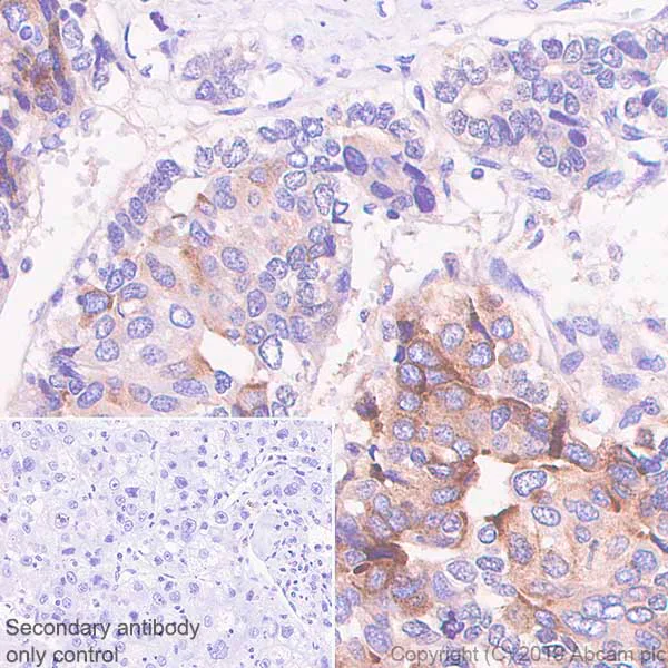 Immunohistochemistry (Formalin/PFA-fixed paraffin-embedded sections) - Anti-alpha 1 Fetoprotein antibody [SP154] (AB130748)