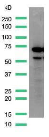 Western blot - Anti-alpha 1 Fetoprotein antibody [SP154] (AB130748)
