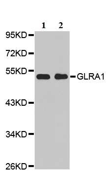Western blot - Anti-alpha 1 Glycine Receptor/GLRA1 antibody (AB192508)