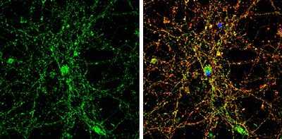 Immunocytochemistry/ Immunofluorescence - Anti-alpha 1 Glycine Receptor/GLRA1 antibody (AB228541), expandable thumbnail