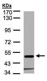Western blot - Anti-alpha 1 Glycine Receptor/GLRA1 antibody (AB228541), expandable thumbnail