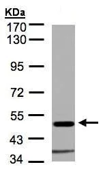 Western blot - Anti-alpha 1 Glycine Receptor/GLRA1 antibody (AB228541)