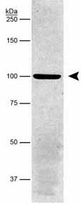 Western blot - Anti-alpha 1 Sodium Potassium ATPase antibody [464.6] (ab7671), expandable thumbnail