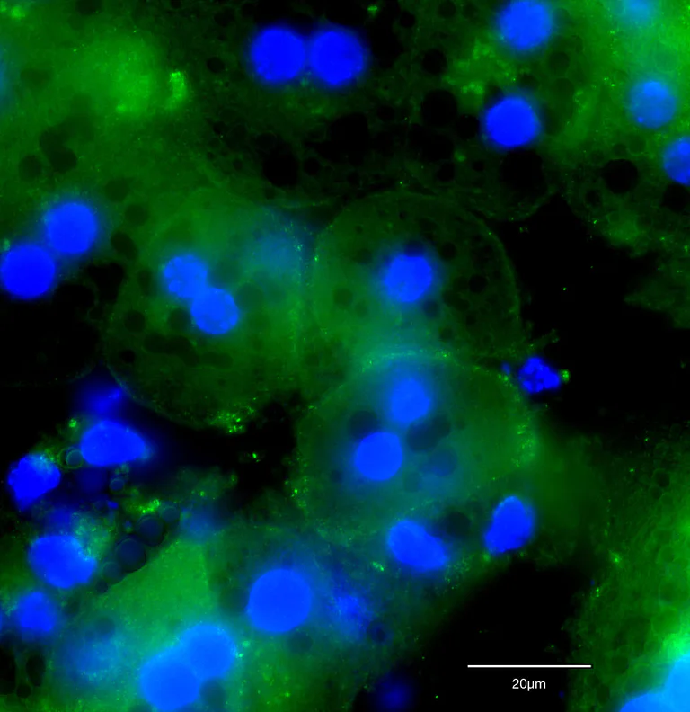 Immunocytochemistry - Anti-alpha 1 Sodium Potassium ATPase antibody [464.6] - Plasma Membrane Loading Control (AB7671)