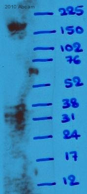 Western blot - Anti-alpha 1 Spectrin antibody [17C7] (AB11751), expandable thumbnail