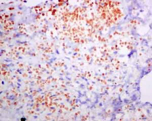 Immunohistochemistry (Formalin/PFA-fixed paraffin-embedded sections) - Anti-alpha 1 Spectrin antibody [EPR9299] (AB154811)