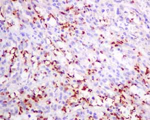 Immunohistochemistry (Formalin/PFA-fixed paraffin-embedded sections) - Anti-alpha 1 Spectrin antibody [EPR9299] (ab154811), expandable thumbnail