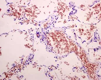 Immunohistochemistry (Formalin/PFA-fixed paraffin-embedded sections) - Anti-alpha 1 Spectrin antibody [EPR9299] (AB154811)