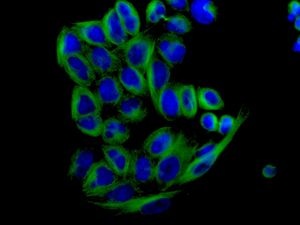 Immunocytochemistry/ Immunofluorescence - Anti-alpha 1a Adrenergic Receptor/ADRA1A antibody [EPR9691(B)] (AB137123), expandable thumbnail