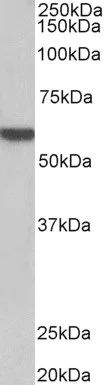 Western blot - Anti-alpha 1b Adrenergic Receptor antibody (AB166925)