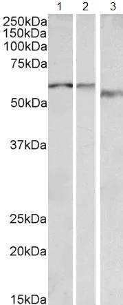Western blot - Anti-alpha 1b Adrenergic Receptor antibody (AB166925)