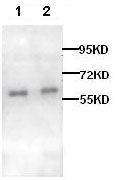 Western blot - Anti-alpha 1d Adrenergic Receptor antibody (AB84402)