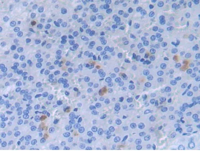 Immunohistochemistry (Formalin/PFA-fixed paraffin-embedded sections) - Anti-Alpha 2 Antiplasmin antibody (AB231226)