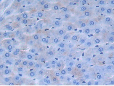 Immunohistochemistry (Formalin/PFA-fixed paraffin-embedded sections) - Anti-Alpha 2 Antiplasmin antibody (AB231226), expandable thumbnail