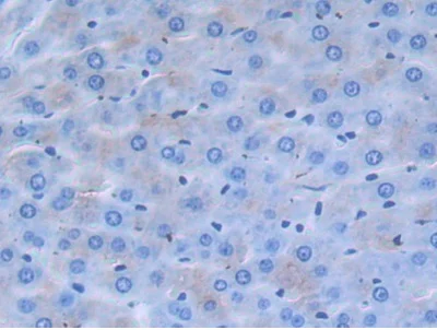 Immunohistochemistry (Formalin/PFA-fixed paraffin-embedded sections) - Anti-Alpha 2 Antiplasmin antibody (AB231226)