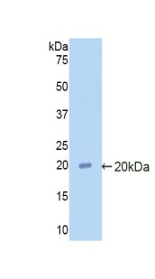 Western blot - Anti-Alpha 2 Antiplasmin antibody (AB231226), expandable thumbnail