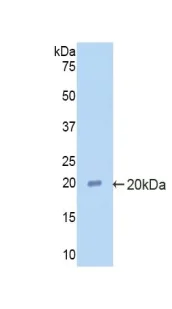Western blot - Anti-Alpha 2 Antiplasmin antibody (AB231226)