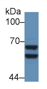 Western blot - Anti-Alpha 2 Antiplasmin antibody (AB231226)