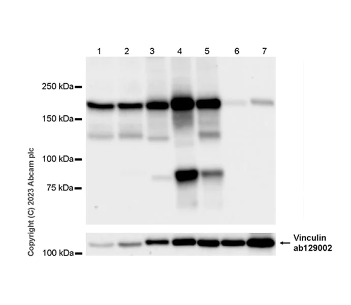 Western blot - Anti-alpha 2 Macroglobulin antibody [EPR25958-49] (AB316101)
