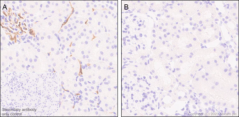 Immunohistochemistry (Formalin/PFA-fixed paraffin-embedded sections) - Anti-alpha 2 Macroglobulin antibody [EPR25958-49] - BSA and Azide free (AB316102)