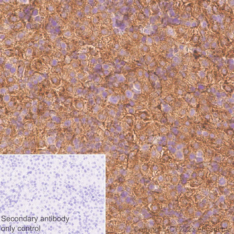 Immunohistochemistry (Formalin/PFA-fixed paraffin-embedded sections) - Anti-alpha 2 Macroglobulin antibody [EPR25958-49] - BSA and Azide free (AB316102)