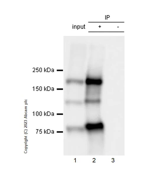 Immunoprecipitation - Anti-alpha 2 Macroglobulin antibody [EPR25958-49] - BSA and Azide free (AB316102)