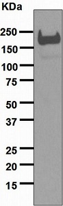 Western blot - Anti-alpha 2 Macroglobulin antibody [EPR4431] (AB133299), expandable thumbnail