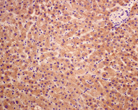 Immunohistochemistry (Formalin/PFA-fixed paraffin-embedded sections) - Anti-alpha 2 Macroglobulin antibody [EPR4432] - BSA and Azide free (AB247855), expandable thumbnail