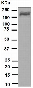 Western blot - Anti-alpha 2 Macroglobulin antibody [EPR4432] - BSA and Azide free (AB247855), expandable thumbnail