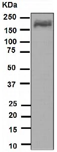 Western blot - Anti-alpha 2 Macroglobulin antibody [EPR4432] - BSA and Azide free (AB247855)