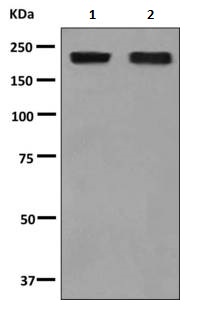 Western blot - Anti-alpha 2 Macroglobulin antibody [EPSISR39] - BSA and Azide free (AB249254), expandable thumbnail