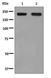 Western blot - Anti-alpha 2 Macroglobulin antibody [EPSISR39] - BSA and Azide free (AB249254)