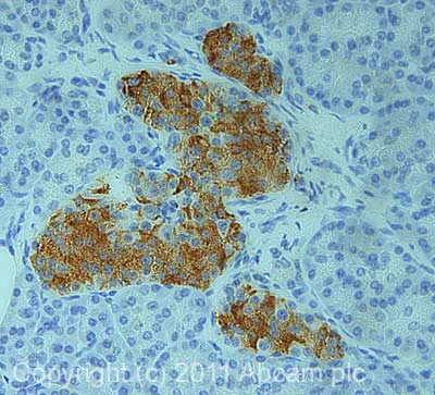 Immunohistochemistry (Formalin/PFA-fixed paraffin-embedded sections) - Anti-alpha 2a Adrenergic Receptor antibody (AB85570)