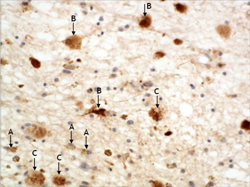 Immunohistochemistry (Formalin/PFA-fixed paraffin-embedded sections) - Anti-alpha A + alpha B Crystallin antibody (AB63998)
