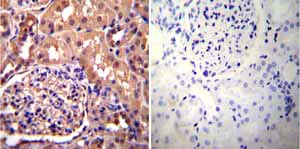 Immunohistochemistry (Formalin/PFA-fixed paraffin-embedded sections) - Anti-alpha Actinin 4 antibody [7H6] - Cytoskeleton Marker (AB32816)