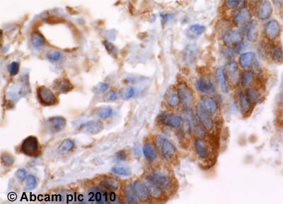 Immunohistochemistry (Formalin/PFA-fixed paraffin-embedded sections) - Anti-alpha Actinin 4 antibody [7H6] - Cytoskeleton Marker (AB32816)