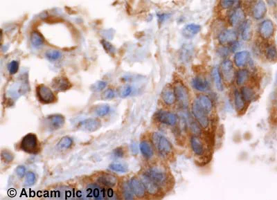 Immunohistochemistry (Formalin/PFA-fixed paraffin-embedded sections) - Anti-alpha Actinin 4 antibody [7H6] - Cytoskeleton Marker (AB32816)