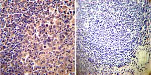 Immunohistochemistry (Formalin/PFA-fixed paraffin-embedded sections) - Anti-alpha Actinin 4 antibody [7H6] - Cytoskeleton Marker (AB32816)